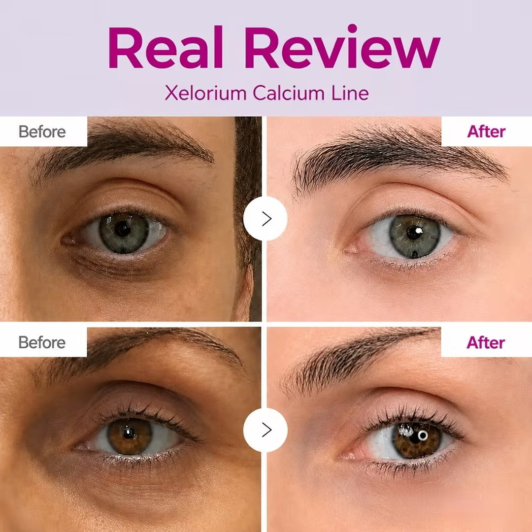 🔥LAST DAY 50% OFF!!Xelorium Korean Calcium Dark Spot Eye Cream