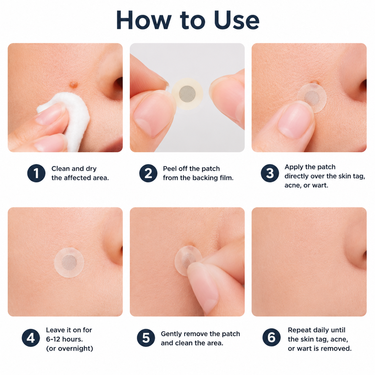 🍁 Xelorium® 2-in-1 Microneedle & Hydrocolloid Patch